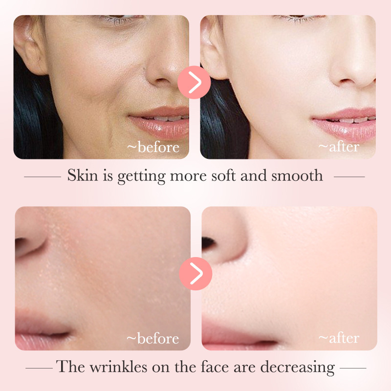 All-english BIOAOUA Nicotinamide Essence for hydrating and shrinking pores Facial serum cross-border export wholesale Item Picture