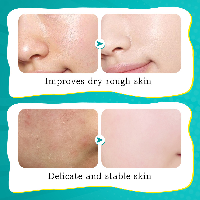 All-english SADOER Avocado Plant Extract Moisturizing Goddess Mask, Hydrating and Moisturizing Mask Patch Cross-border export wholesale Item Picture