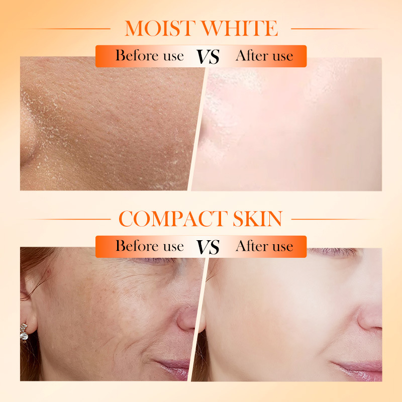 All-english SADOER Five-layer Vitamin C Whitening, Firming and Moisturizing Lotion Cross-border export wholesale Application Scenario