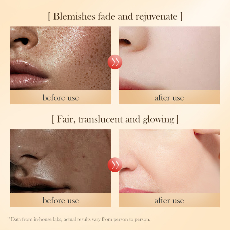 Cross-border export wholesale of all-English SADOER Whitening Capsules, Whitening Essence Oil and Texture Brightening Essence liquid Item Picture