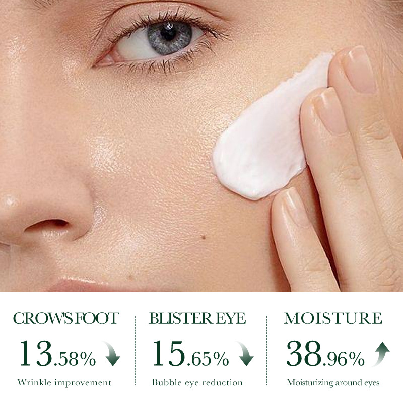 SADOER tea Tree Acne and Oil Control Cream, student face anti-acne Cream, cross-border export wholesale Item Picture