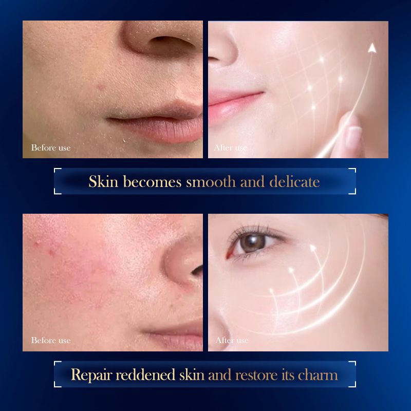 Cross-border export wholesale of SADOER hyaluronic acid B5 Hydrating and Repairing sleep Mask and skin rejuvenation mask Item Picture