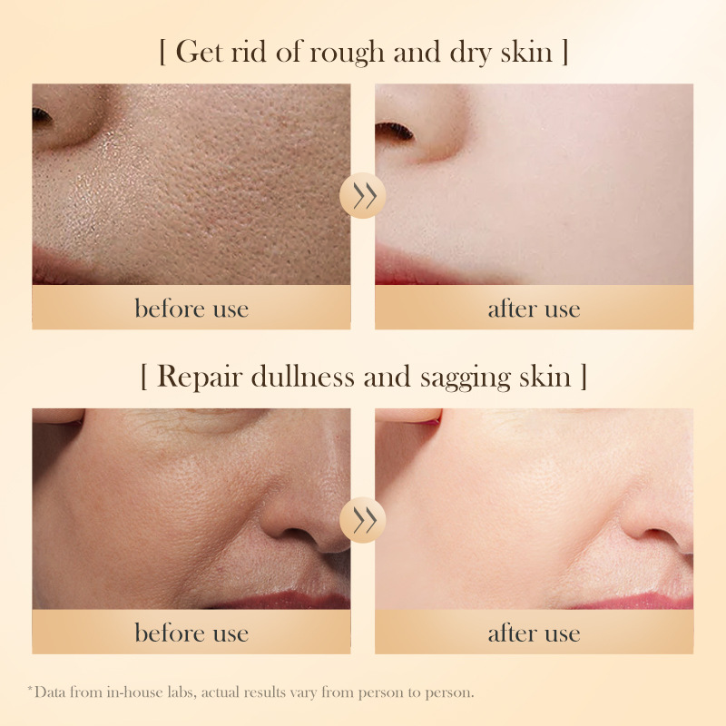 Cross-border export wholesale of SADOER Snail Rose Capsule Essence Lotion, Moisturizing and Nourishing Water Cream Item Picture