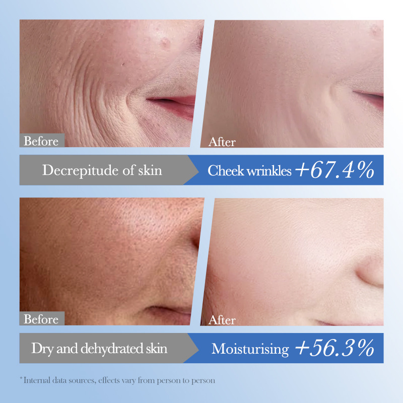 Cross-border export wholesale of SADOER caviar hyaluronic acid Anti-wrinkle Repair Moisturizing Facial Cleanser Application Scenario