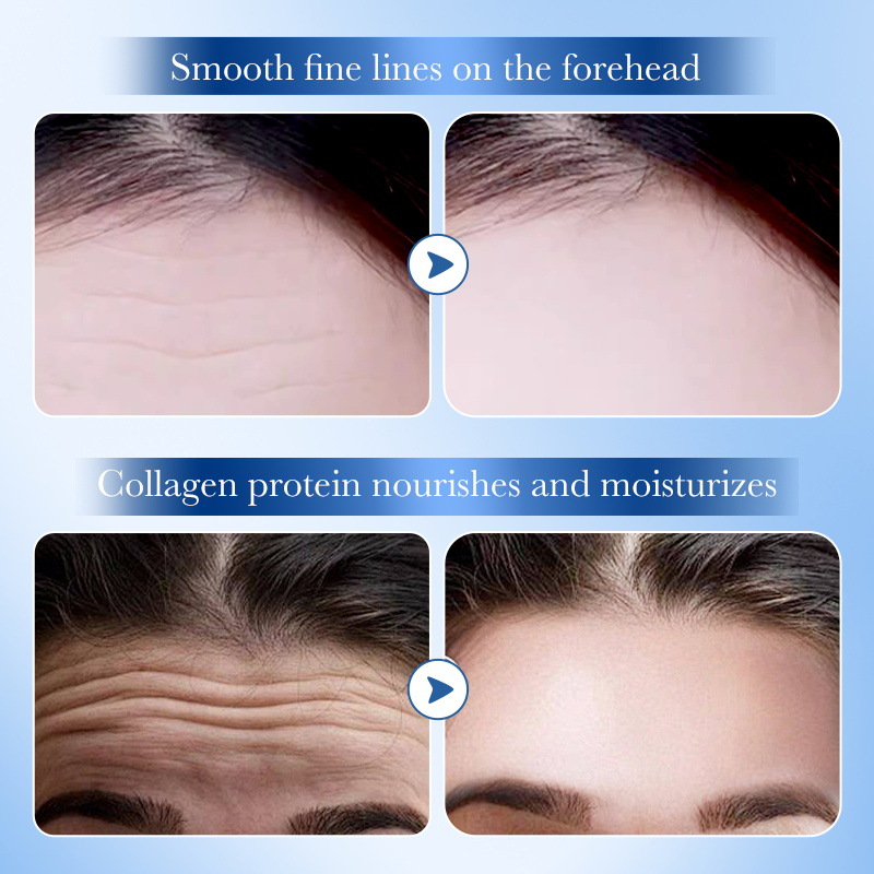 All-english SADOER Hyaluronic Acid Collagen Firming Forehead Patch for improving forehead wrinkles Cross-border export wholesale details Picture