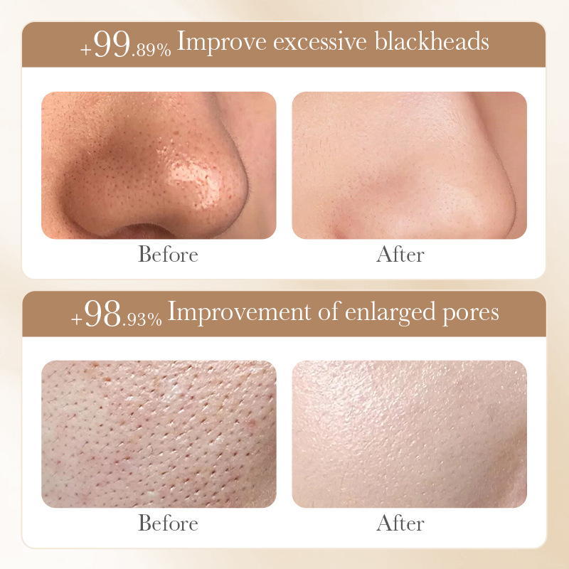 All-english BIOAOUA Rice puree peel-off Mask for absorbing blackheads, acne and keratin, cross-border export wholesale Item Picture