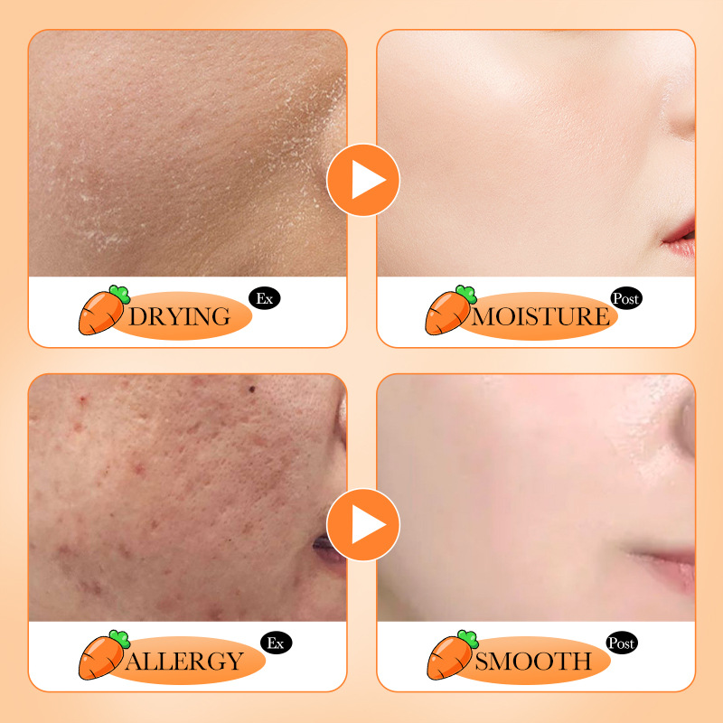 Full English SADOER beta-carrot Essence Moisturizing and Nourishing Skin Essence Serum Cross-border export wholesale Item Picture