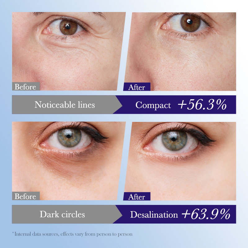 SADOER Evening Primrose Vitamin E Nourishing Firming Eye Cream and Moisturizing Eye Cream cross-border export wholesale Application Scenario