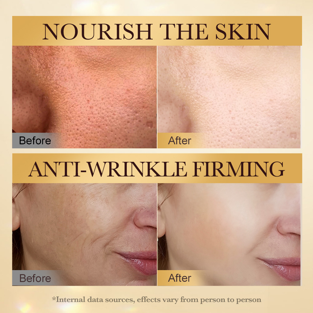 Cross-border export wholesale of SADOER Bee Venom Anti-Wrinkle Firming Nourishing Essence and Hydrating Skin Nourishing Essence in full English Item Picture