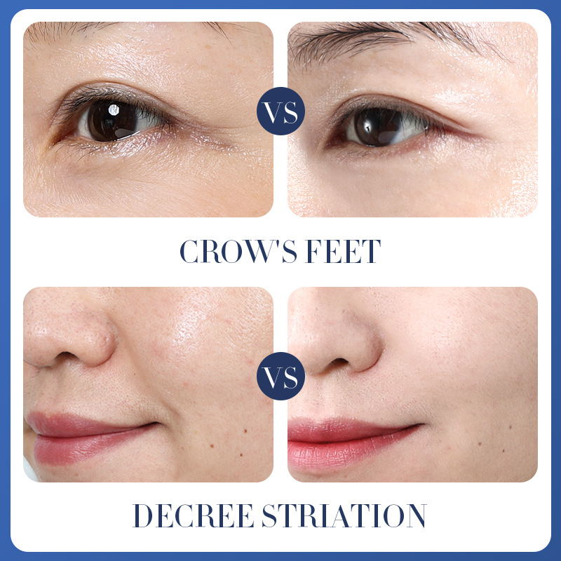 All-english BIOAOUA double-leaved yeast anti-Wrinkle Facial mask Hydrating Facial Mask cross-border export wholesale Application Scenario
