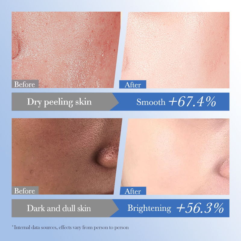 All-english BIOAOUA Ceramide Hyaluronic acid Moisturizing Cream, Moisturizing face cream, cross-border export wholesale Application Scenario