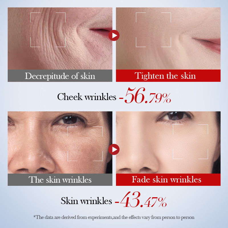 Full English SADOER Snail Collagen Anti-Wrinkle Lotion Moisturizing Facial Water and Lotion cross-border export wholesale Application Scenario
