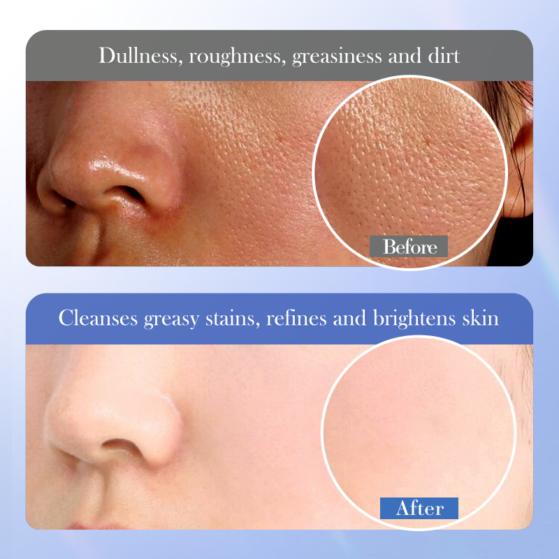 All-english BIOAOUA ceramide Salicylic Acid Facial Cleanser and Cleansing facial Cleanser cross-border export wholesale Application Scenario