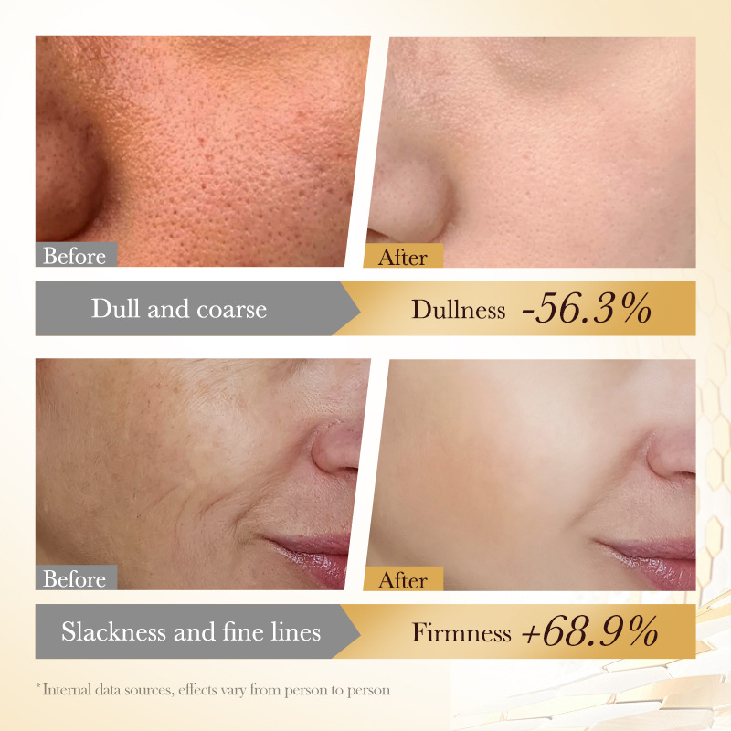 SADOER bee Venom Anti-Wrinkle, Firming and Gentle Facial Cleanser, cross-border export wholesale Item Picture