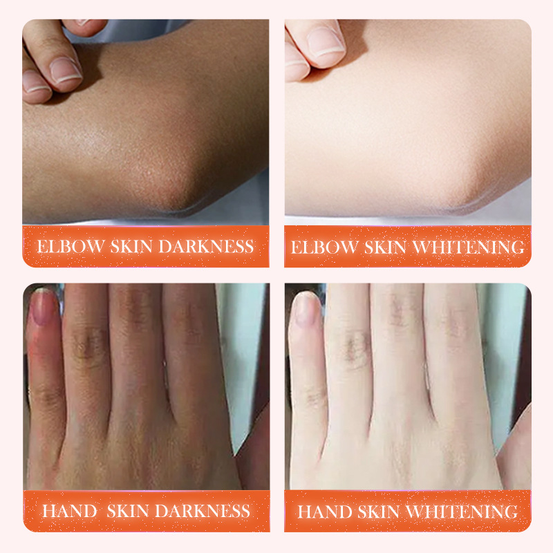 All-english SADOER Joint Whitening and Darkening Essence, a universal essence for body whitening, cross-border wholesale Application Scenario