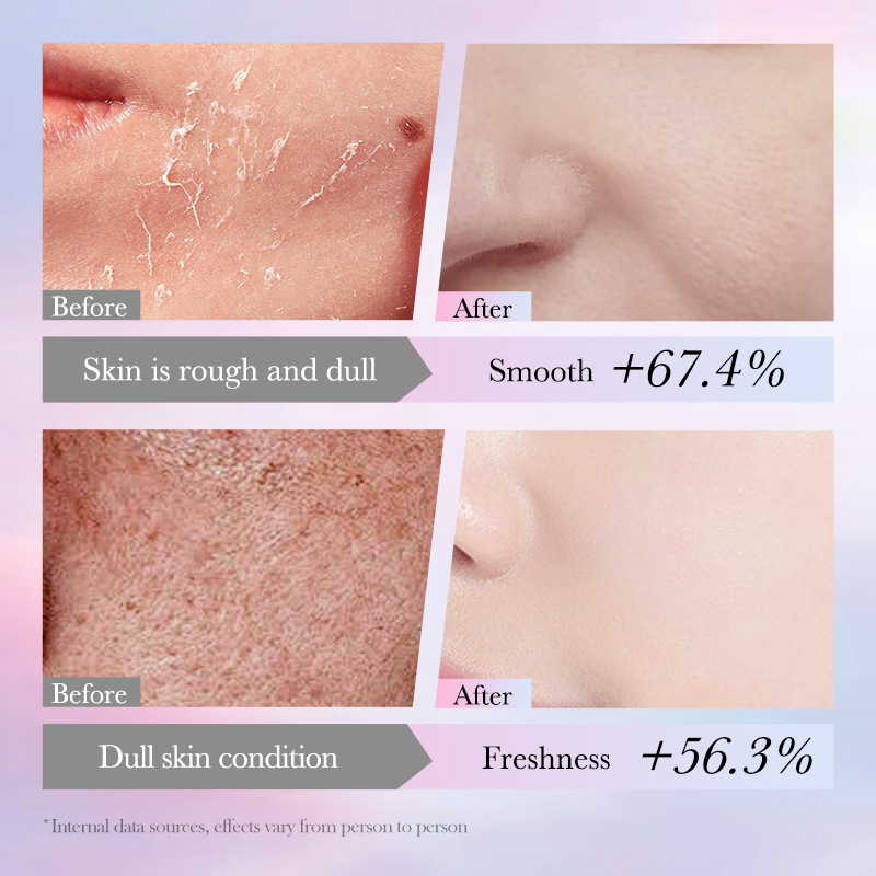Cross-border wholesale of SADOER nicotinamide whitening, freckle-removing and repairing Facial mask in English Application Scenario