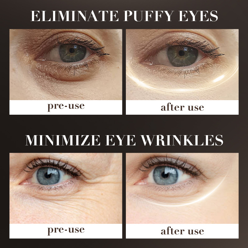 SADOER Retinol Electric Eye Cream for firming, moisturizing and reducing wrinkles, cross-border export wholesale Application Scenario