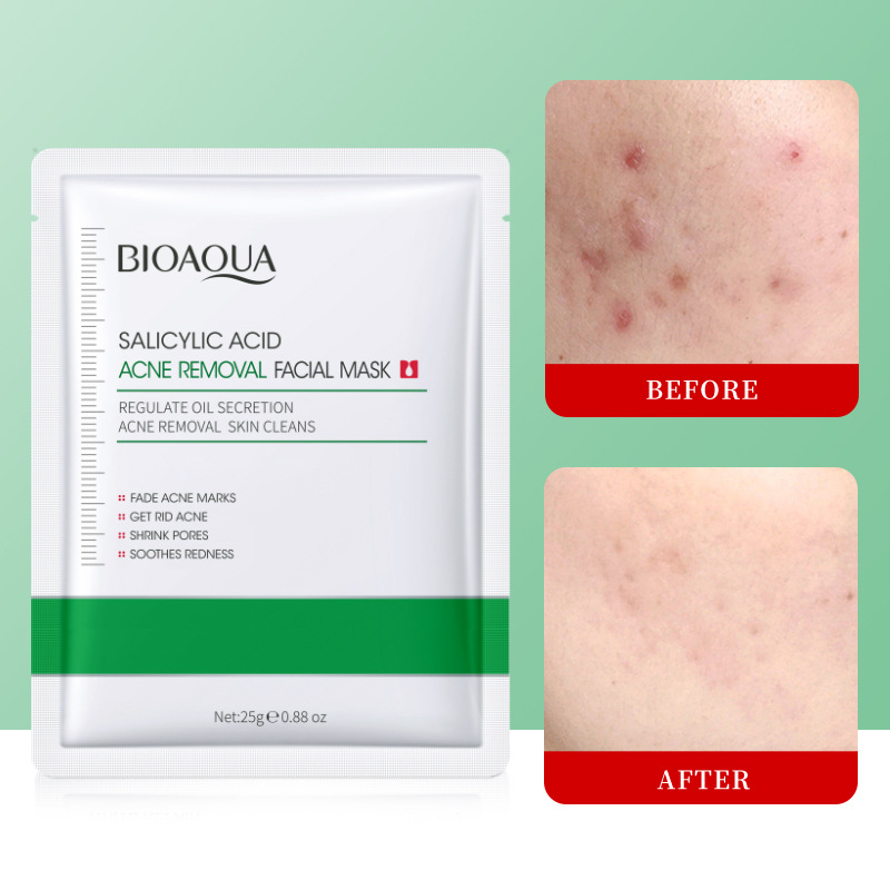 All-english BIOAOUA Salicylic acid Acne Facial mask Hydrating and Nourishing Mask Cross-border export wholesale Item Picture