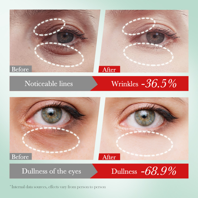 SADOER Nicotinamide Whitening Multi-Effect Brightening Eye Cream and Moisturizing Dual-Effect Eye Cream Cross-border export wholesale details Picture