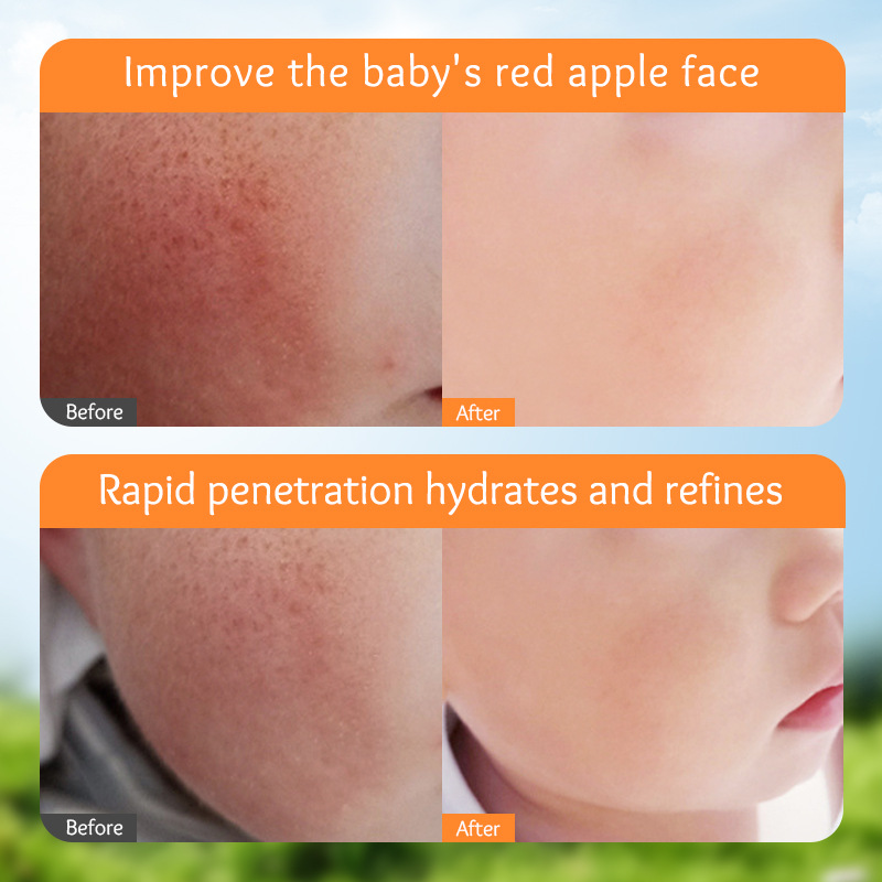 Cross-border export wholesale of SADOER Children's Calendula Moisturizing Hydrating Cream Item Picture