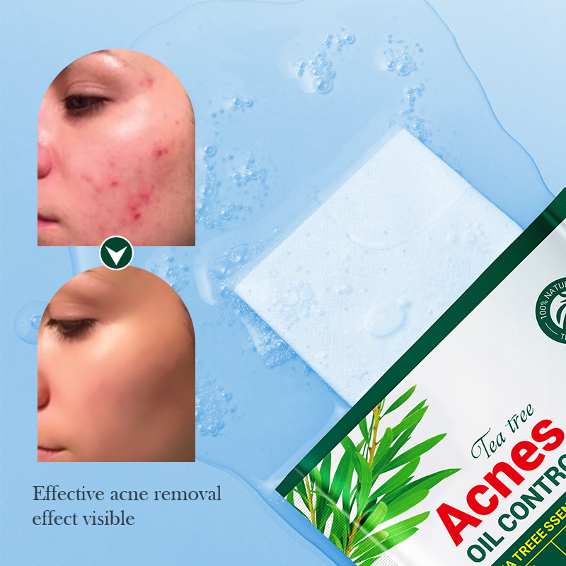 All-english SADOER tea tree Acne and Oil Control Facial mask Student hydrating Mask cross-border export wholesale Item Picture