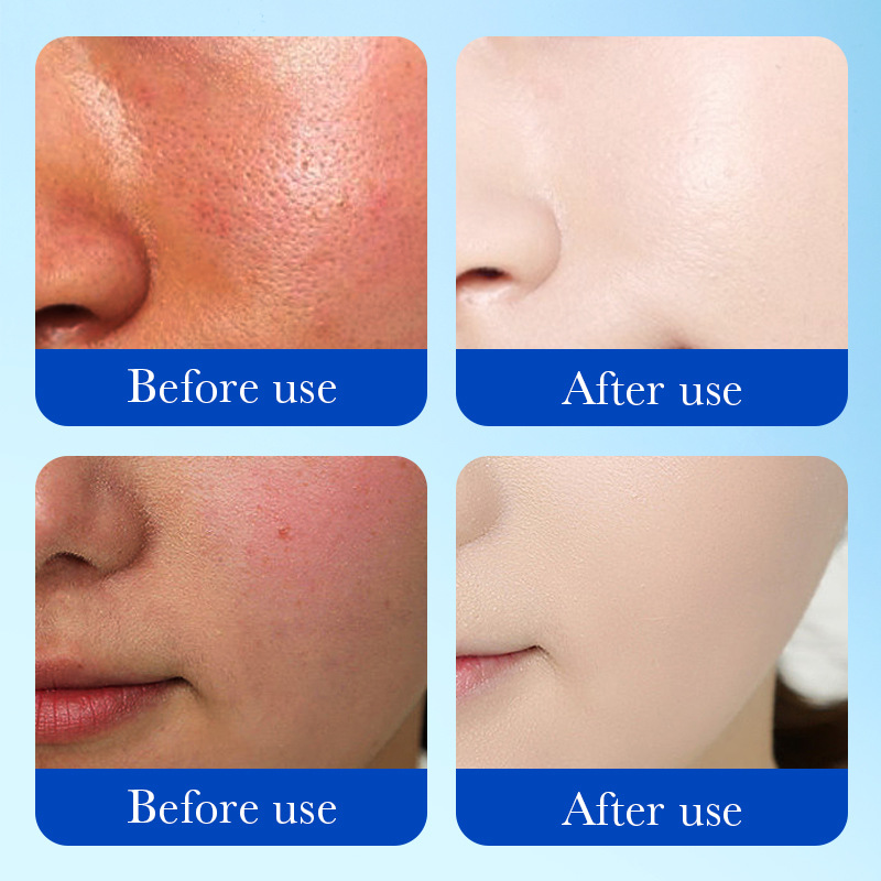 Cross-border export wholesale of SADOER Vitamin B5 Moisturizing, Nourishing and Repairing Cream and skin softening Cream Item Picture