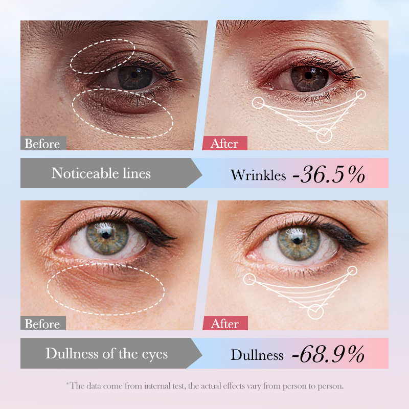 Cross-border wholesale of SADOER Four-in-One Multi-effect Firming and Nourishing Eye Cream and moisturizing eye cream in English Item Picture