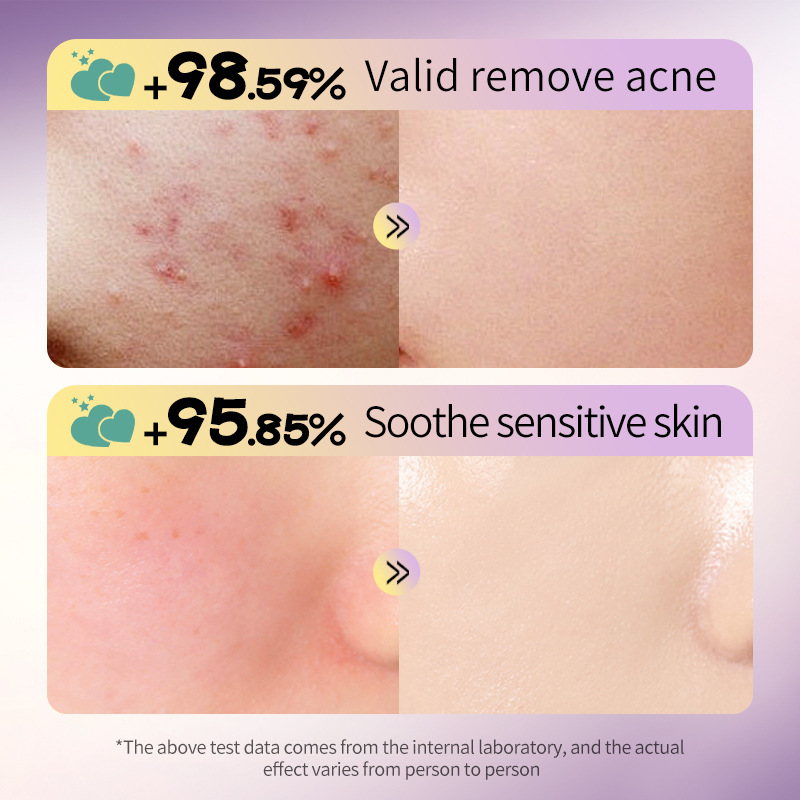 All-english SADOER Star Heart-shaped hydrocolloid Acne Patches - Light Green 72 acne patches Cross-border export wholesale Specification drawing