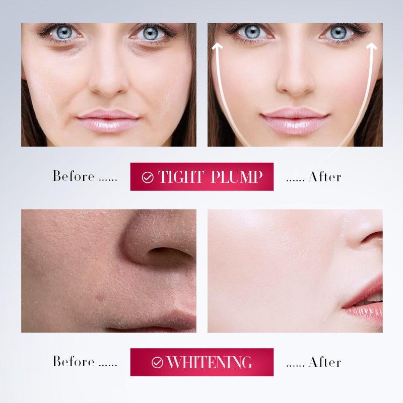 SADOER V Face Lifting and Firming Cream for firming the skin, cross-border export wholesale Application Scenario