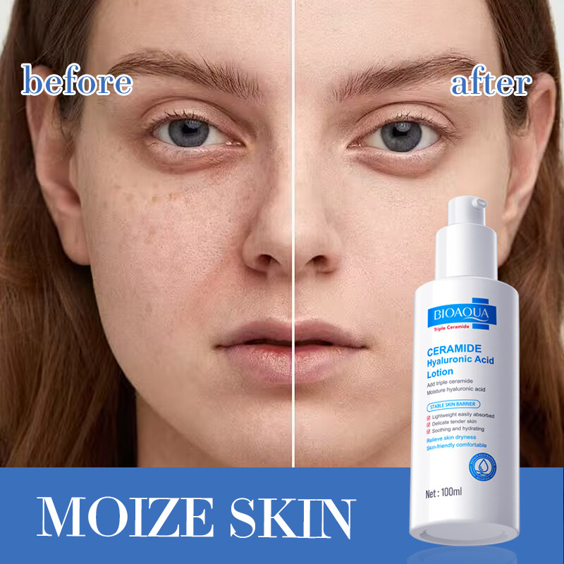 All-english BIOAOUA ceramide Hyaluronic acid Moisturizing Lotion for moisturizing the skin cross-border export wholesale Application Scenario