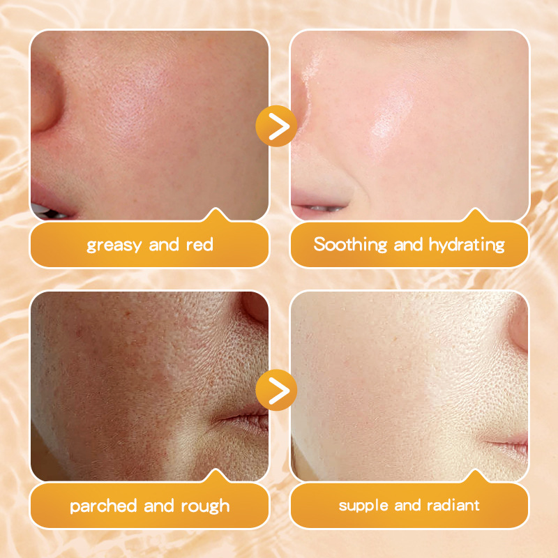 SADOER Baby Skin Moisturizing and Hydrating Mask Patch Cross-border export wholesale Item Picture