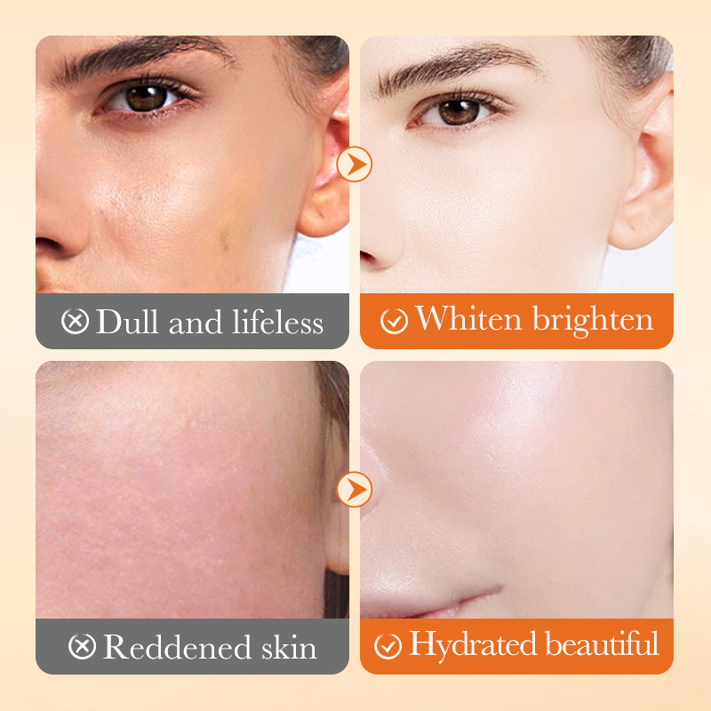 Cross-border export wholesale of SADOER Vitamin C Squalane Hydrating Nourishing Repair Cream and Skin Softening Cream Application Scenario