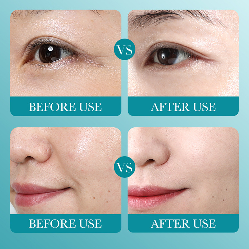 All-english BIOAOUA Hyaluronic Acid Intensive Hydrating Nourishing Facial mask Cross-border export wholesale Application Scenario