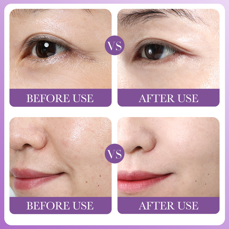 All-english BIOAOUA Retinol Moisturizing and Firming Facial mask Cross-border export wholesale Application Scenario