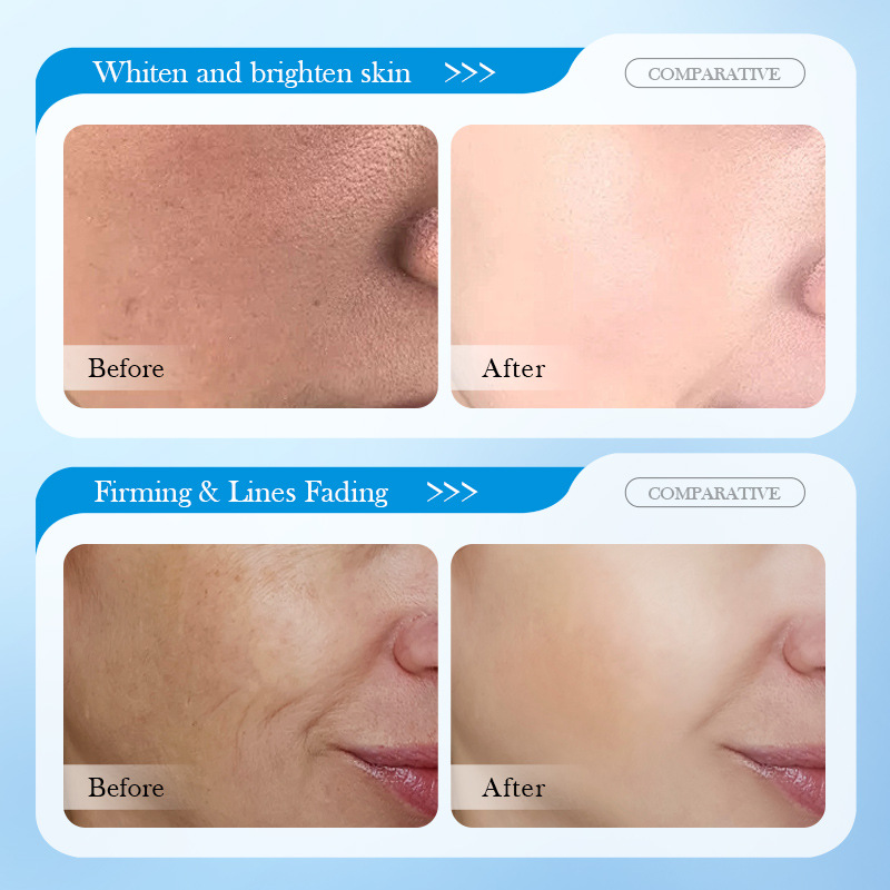 Cross-border export wholesale of SADOER8D Hyaluronic Acid Anti-Wrinkle Hydrating Nourishing Cream and Moisturizing Skin Cream Item Picture