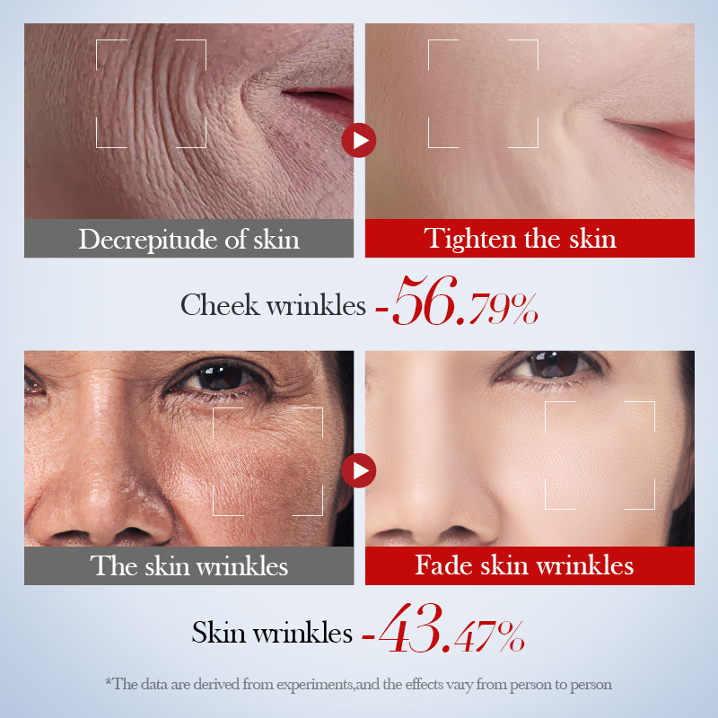 SADOER Snail Collagen Anti-Wrinkle Essence in Full English for hydrating, moisturizing and nourishing the skin cross-border export wholesale Application Scenario