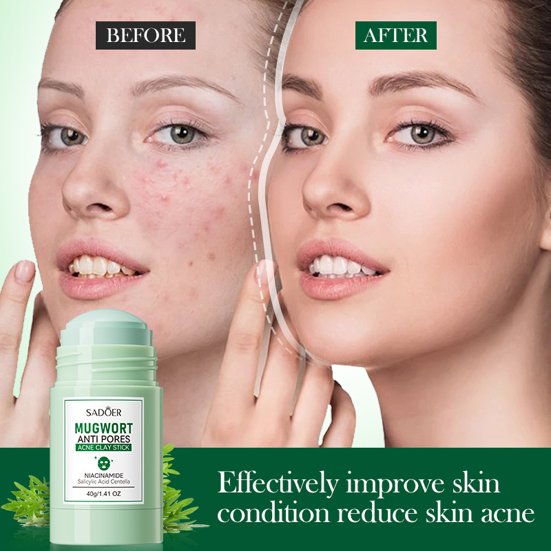 All-english SADOER mugwort mud mask sticks for deep cleansing and acne removal, gentle student cleansing mud masks for cross-border wholesale Application Scenario