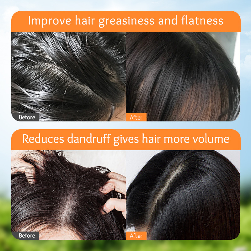 SADOER Children's Calendula amino Acid Volumizing Shampoo and Cleansing Shampoo are available for wholesale across overseas markets Item Picture