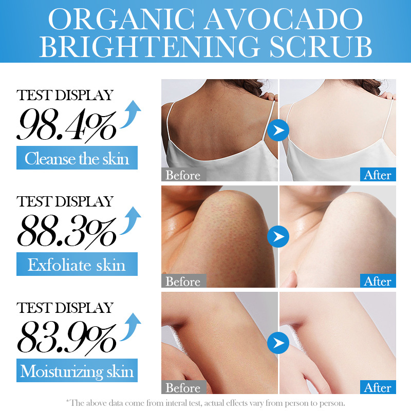SADOER Avocado Nicotinamide Brightening Scrub for Cleansing the body cross-border export wholesale Item Picture