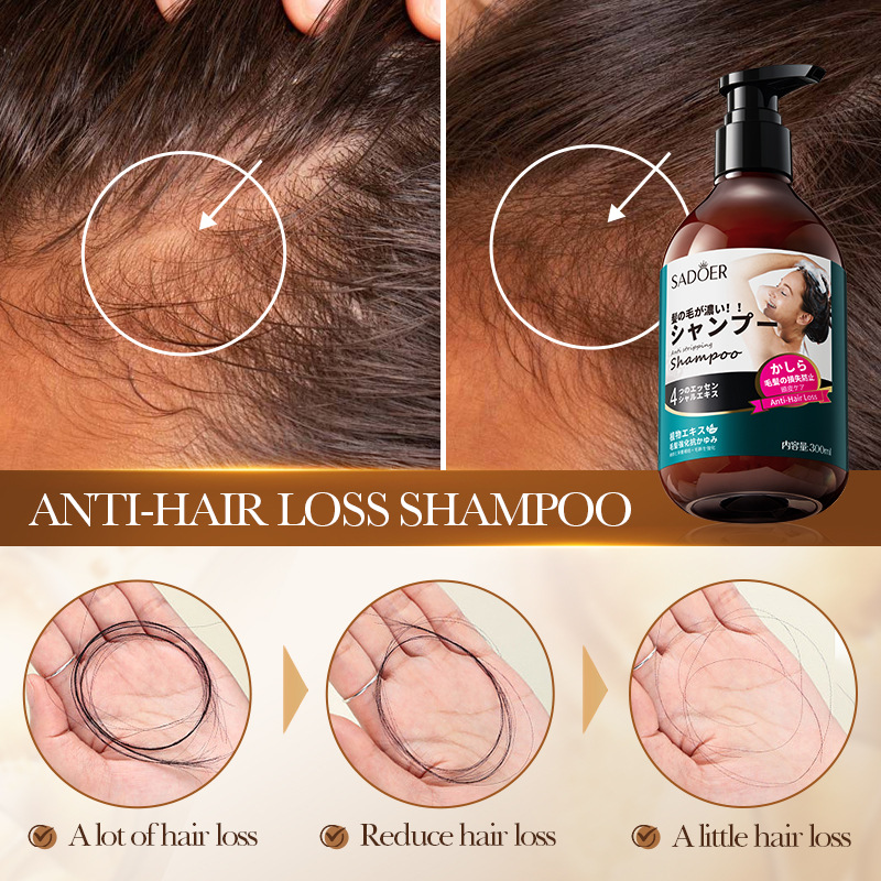 All-english SADOER anti-hair loss shampoo, anti-dandruff foam anti-hair loss shampoo cross-border export wholesale Application Scenario