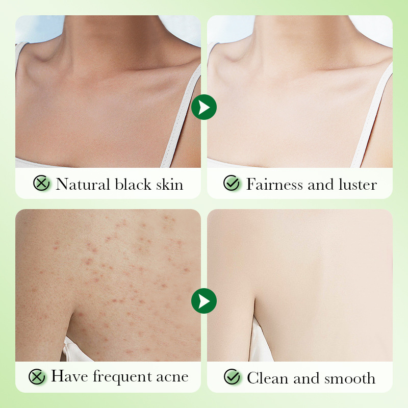 SADOER kiwi body Scrub, a cross-border wholesale body wash for cleansing Item Picture