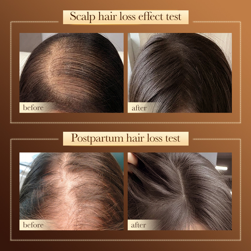 Cross-border export wholesale of SADOER Hydrating, Smooth and anti-hair Loss Shampoo and anti-dandruff shampoo in full English Item Picture