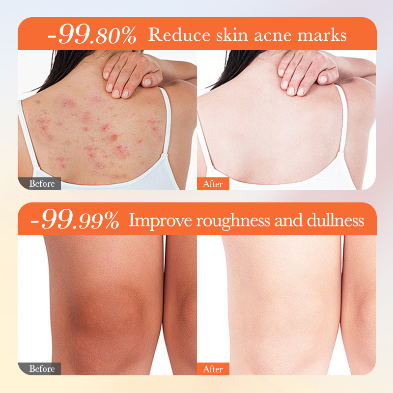 Cross-border wholesale of SADOER Vitamin C Whitening Bath Oil and Deep Cleansing body bath liquid Item Picture