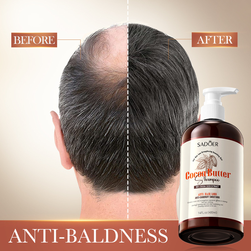 Cross-border wholesale of SADOER cocoa butter anti-hair loss shampoo and hair cleaning shampoo in English Item Picture