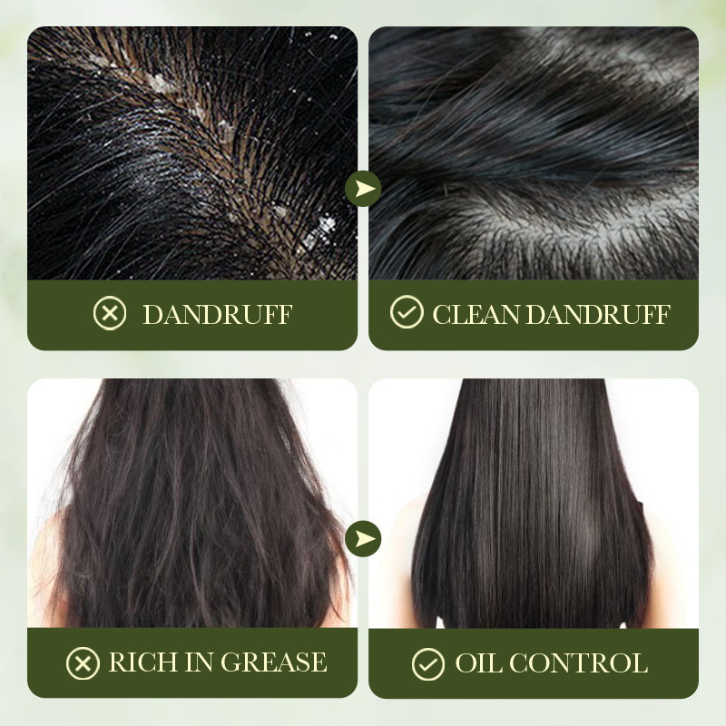 All-english SADOER olive oil Nourishing Anti-dandruff Shampoo, Smooth anti-dandruff shampoo cross-border export wholesale Item Picture
