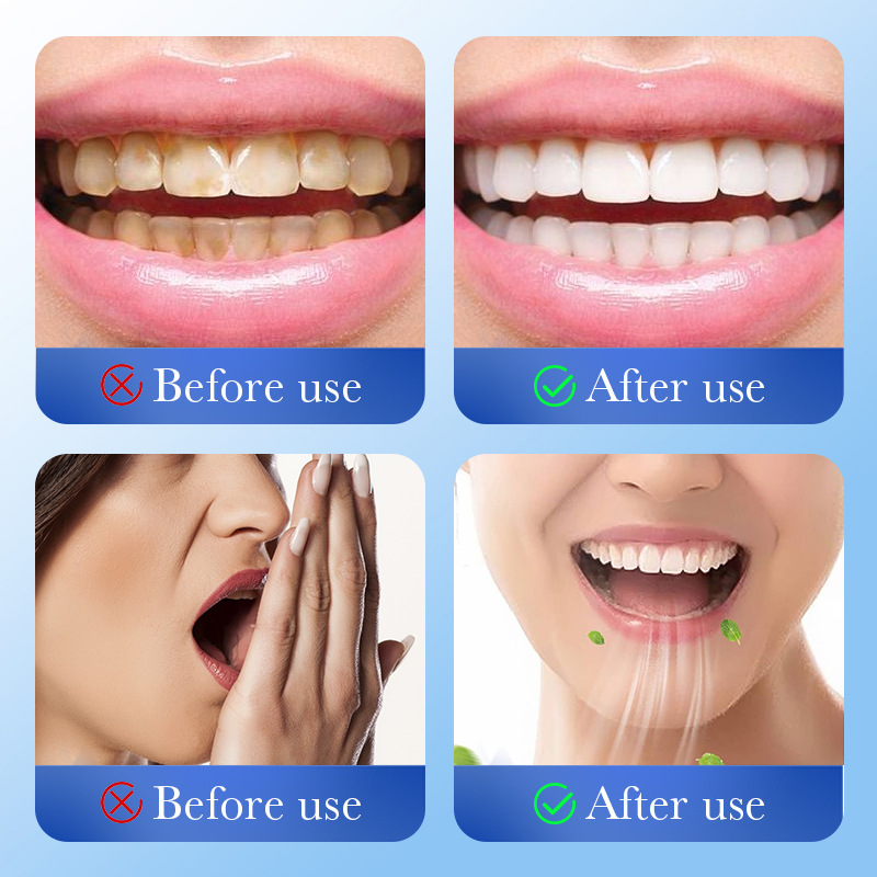 All-english SADOER Ginger and Mint multi-effect Gum Care Toothpaste for cleaning tartar and strengthening teeth cross-border export wholesale Application Scenario
