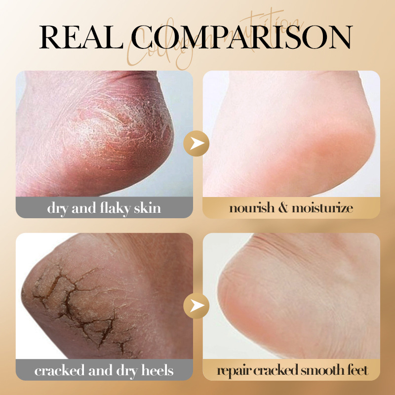 SADOER Bone Collagen Anti-wrinkle Nourishing Foot Cream for autumn and winter cross-border export wholesale Application Scenario