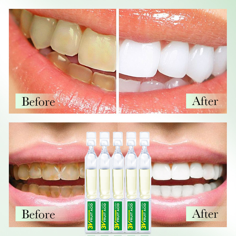 All-english SADOER3V fruit acid teeth Whitening Essence cleans teeth and freshens the mouth. Cross-border export wholesale Item Picture