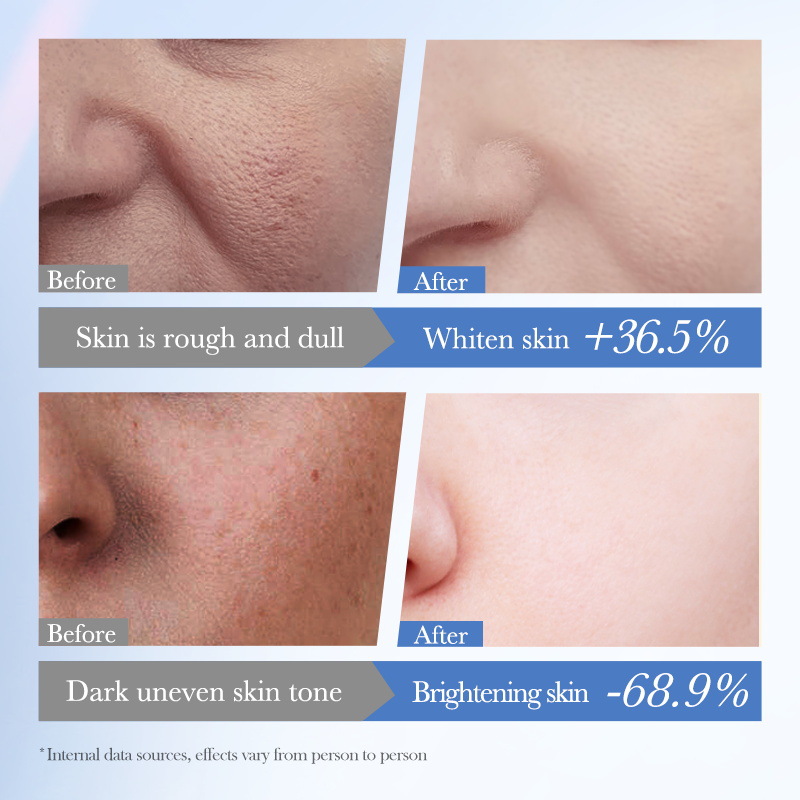 SADOER White Rice Nicotinamide Brightening Skin Care Product Set, Face Cream and Facial Cleanser cross-border export wholesale Application Scenario