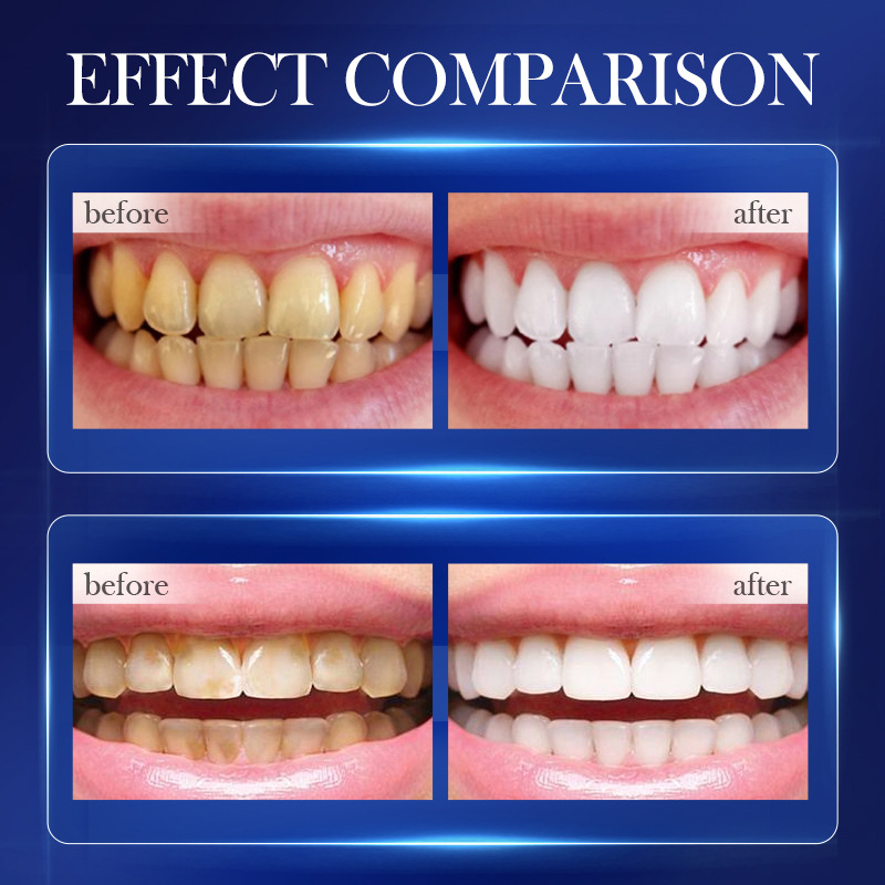 SADOER White and Refreshing baking Soda Toothpaste for teeth cleaning, cross-border export wholesale Item Picture